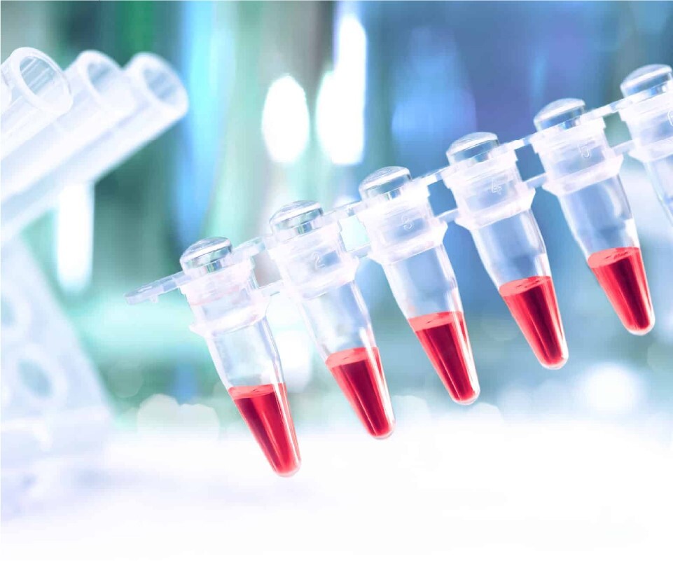 کدام آزمایشگاههای استان تهران در ماه رمضان فعال هستند؟ خدمات آزمایشگاهی پرتکرار تهران لب و پارس لب در ماه رمضان